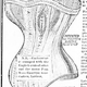 Illustration for article titled Zap Yourself Healthy With The Electric Corset, 1883